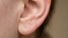 De ce avem atât de multă ceară în urechi: adevărul despre care nu se vorbește